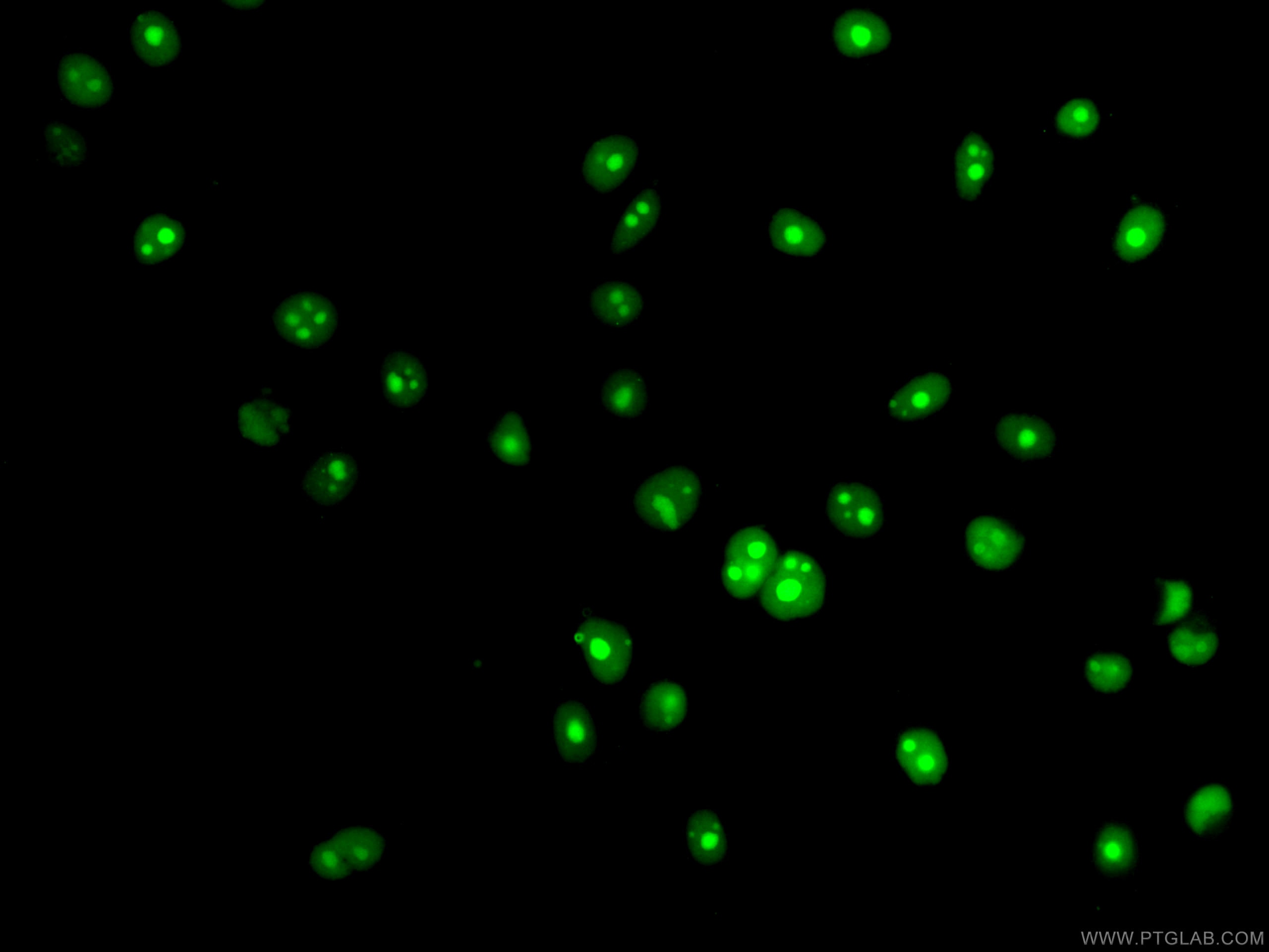 Immunofluorescence (IF) / fluorescent staining of HepG2 cells using CoraLite® Plus 488-conjugated NSUN2 Monoclonal ant (CL488-66580)