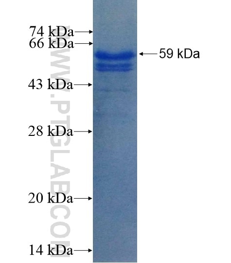 NSUN2 fusion protein Ag14791 SDS-PAGE