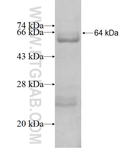 NSUN3 fusion protein Ag9789 SDS-PAGE