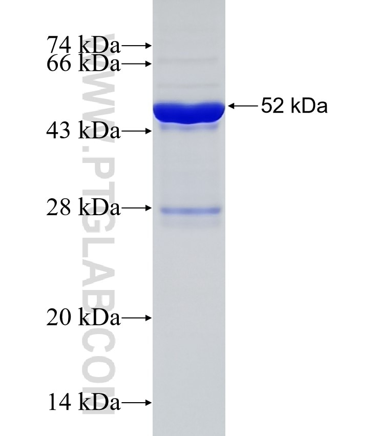 NSUN4 fusion protein Ag31821 SDS-PAGE