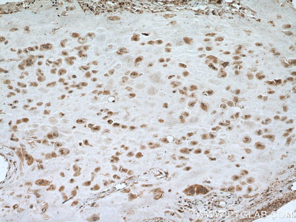 Immunohistochemistry (IHC) staining of human placenta tissue using NSUN5 Polyclonal antibody (15449-1-AP)