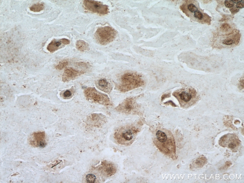 Immunohistochemistry (IHC) staining of human placenta tissue using NSUN5 Polyclonal antibody (15449-1-AP)