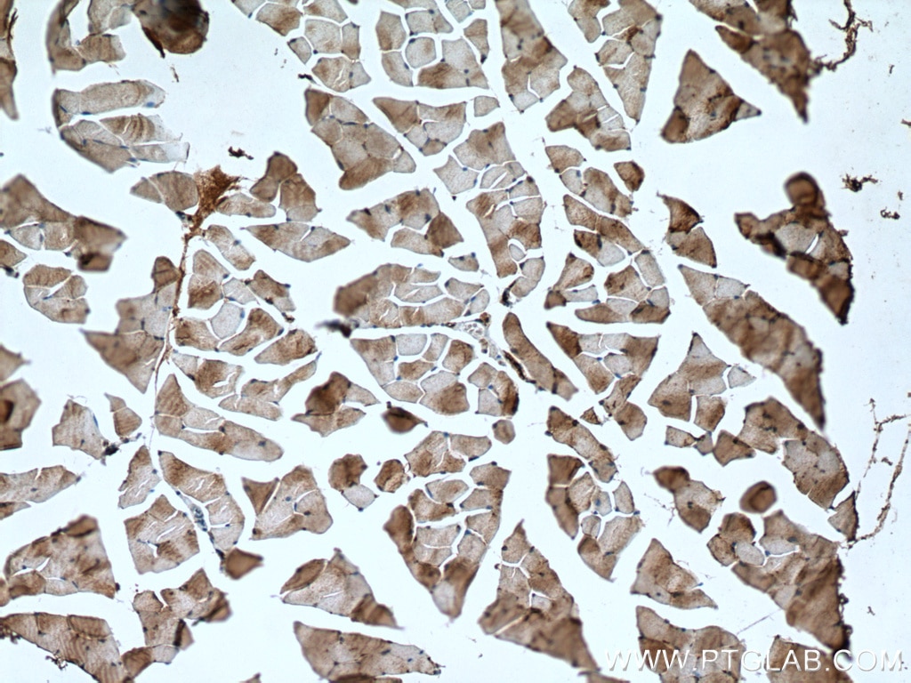 Immunohistochemistry (IHC) staining of mouse skeletal muscle tissue using NSUN5 Polyclonal antibody (15449-1-AP)