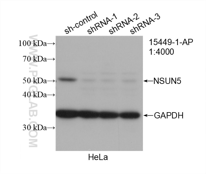 Western Blot (WB) analysis of HeLa cells using NSUN5 Polyclonal antibody (15449-1-AP)