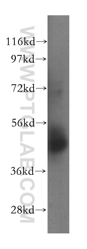 Western Blot (WB) analysis of human placenta tissue using NSUN5 Polyclonal antibody (15449-1-AP)