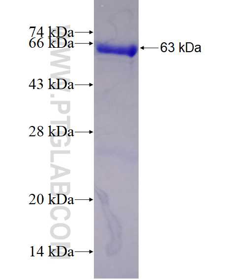 NSUN5 fusion protein Ag7711 SDS-PAGE
