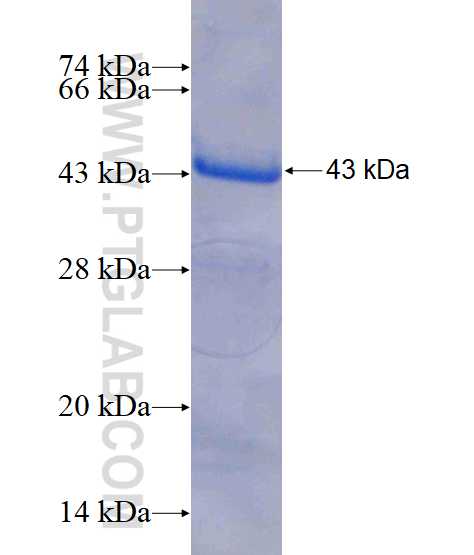 NSUN5 fusion protein Ag7868 SDS-PAGE