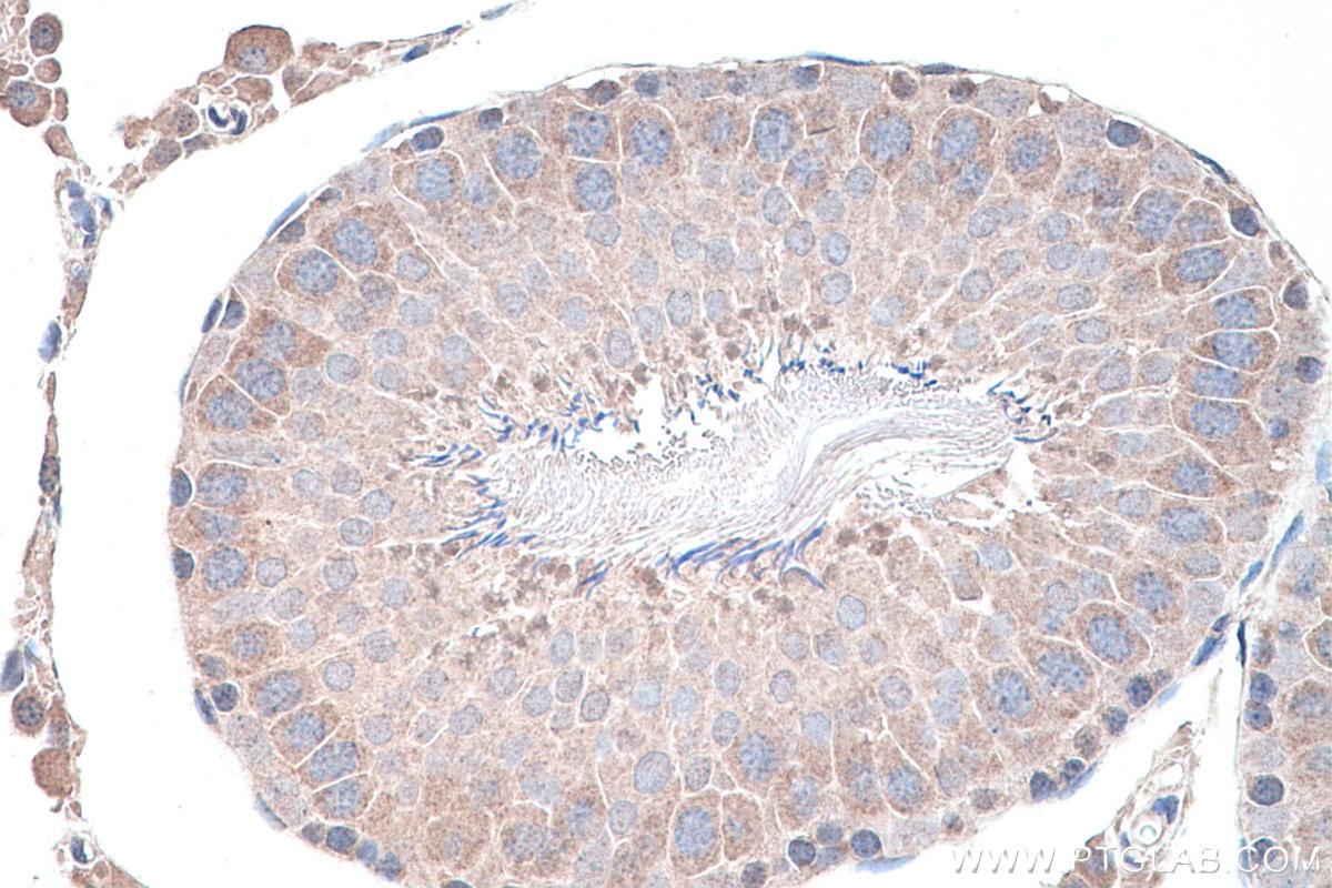Immunohistochemistry (IHC) staining of rat testis tissue using NSUN7 Polyclonal antibody (17546-1-AP)