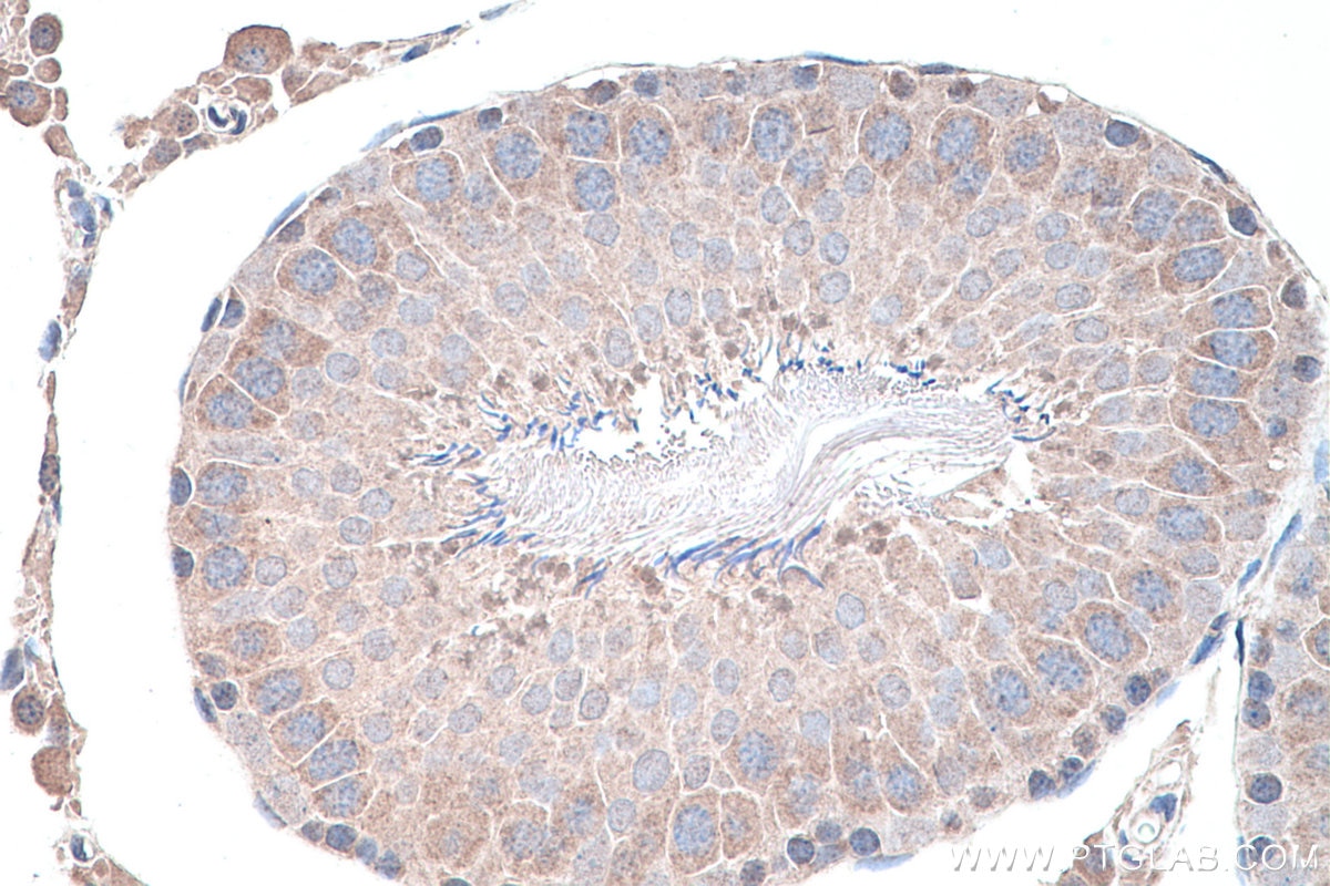 IHC staining of rat testis using 17546-1-AP