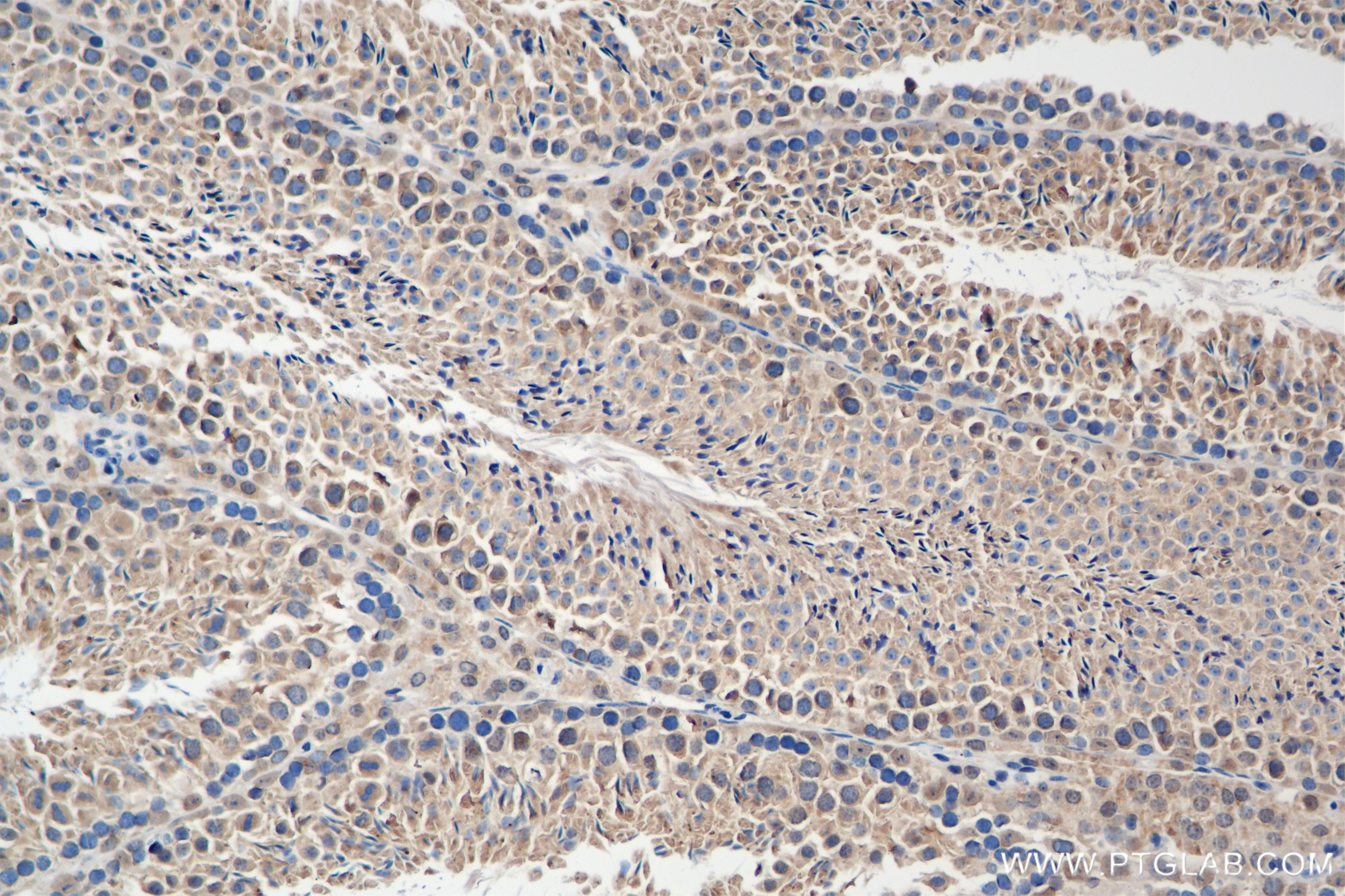 Immunohistochemistry (IHC) staining of mouse testis tissue using NSUN7 Recombinant antibody (84795-1-RR)