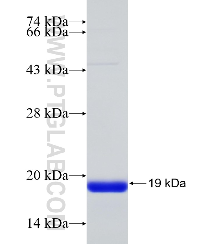 NSUN7 fusion protein Ag31872 SDS-PAGE