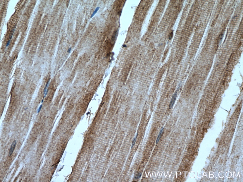 Immunohistochemistry (IHC) staining of mouse skeletal muscle tissue using NT5C Polyclonal antibody (16577-1-AP)