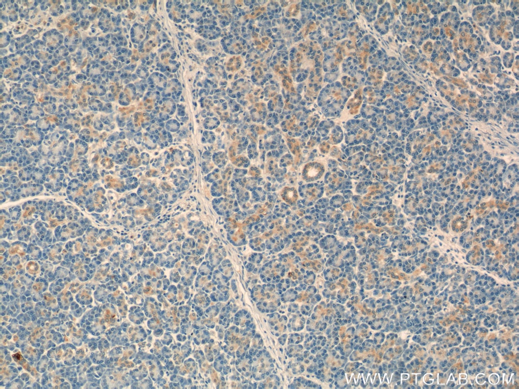 Immunohistochemistry (IHC) staining of human pancreas tissue using NT5C Polyclonal antibody (16577-1-AP)