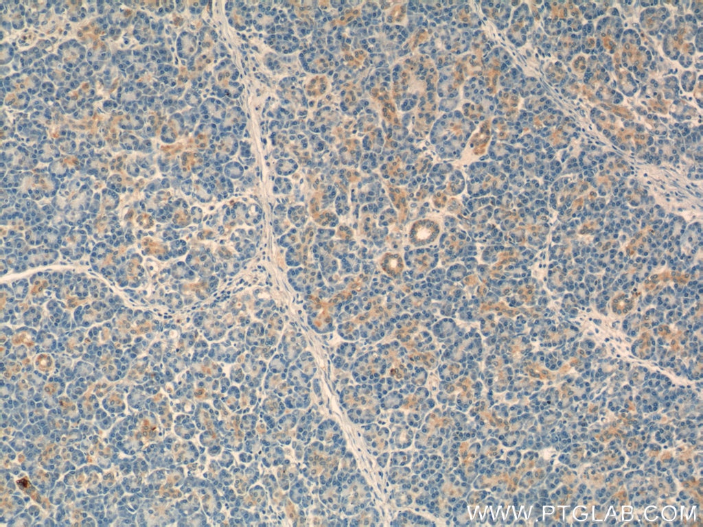 IHC staining of human pancreas using 16577-1-AP