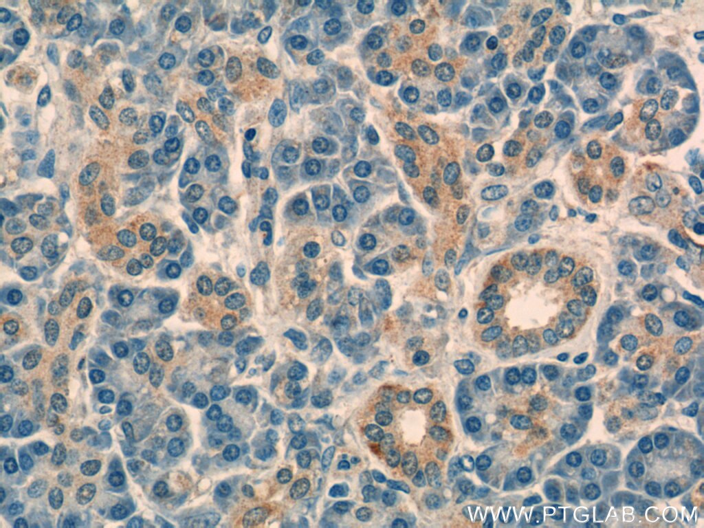 Immunohistochemistry (IHC) staining of human pancreas tissue using NT5C Polyclonal antibody (16577-1-AP)