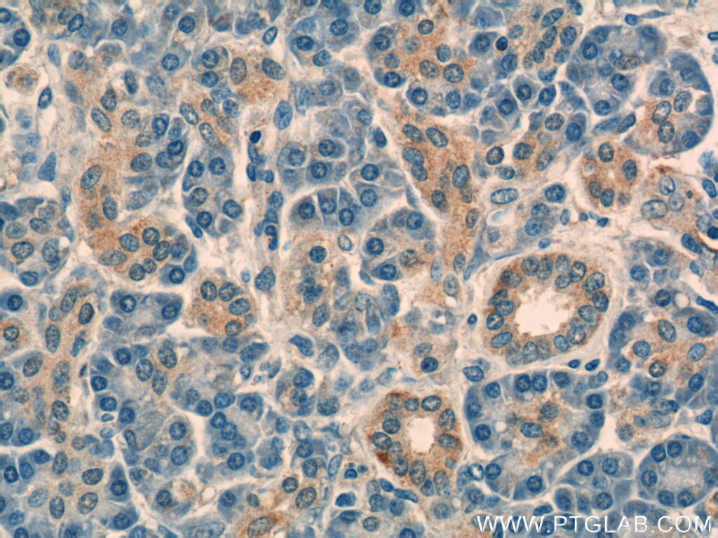 IHC staining of human pancreas using 16577-1-AP