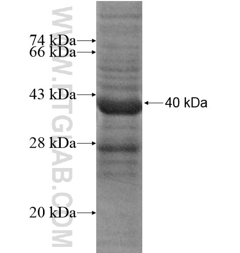 NT5C1A fusion protein Ag15802 SDS-PAGE