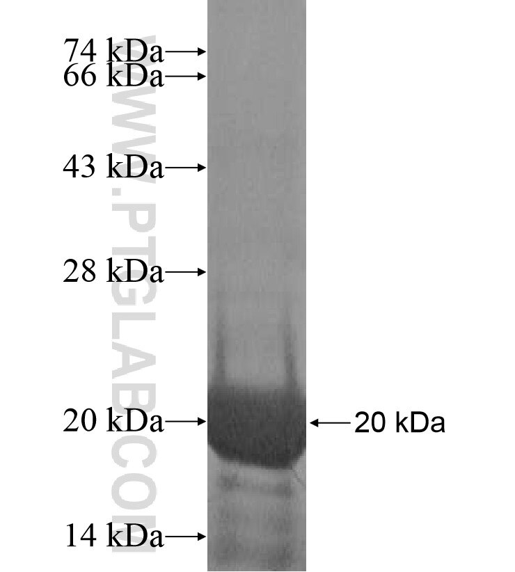 NT5C1A fusion protein Ag17185 SDS-PAGE NT5C1A fusion protein Ag17185 SDS-PAGE