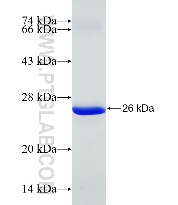 NT5C1B fusion protein Ag31771 SDS-PAGE
