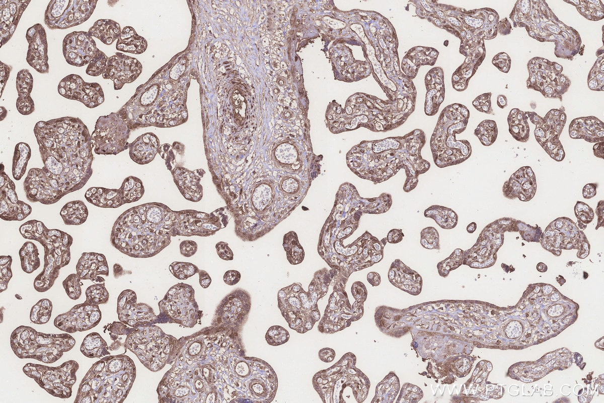 Immunohistochemistry (IHC) staining of human placenta tissue using NT5C2 Polyclonal antibody (15223-1-AP)