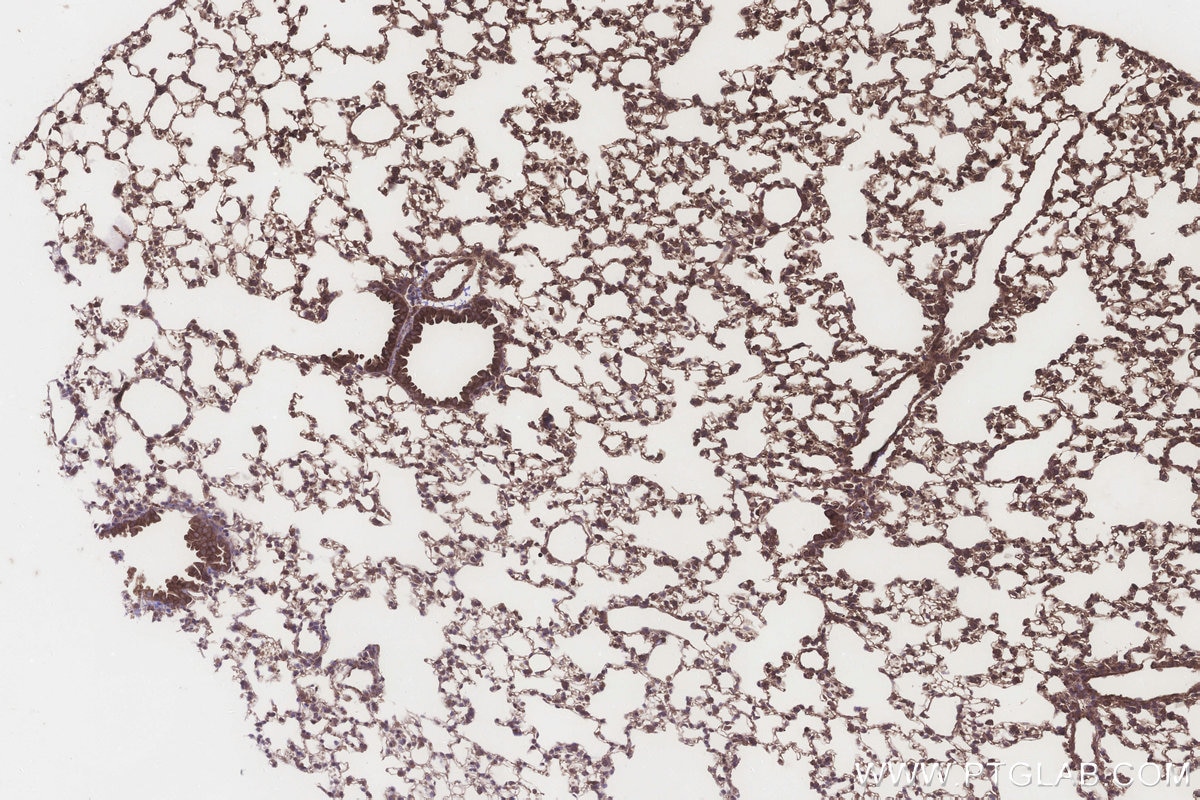 Immunohistochemistry (IHC) staining of mouse lung tissue using NT5C2 Polyclonal antibody (15223-1-AP)