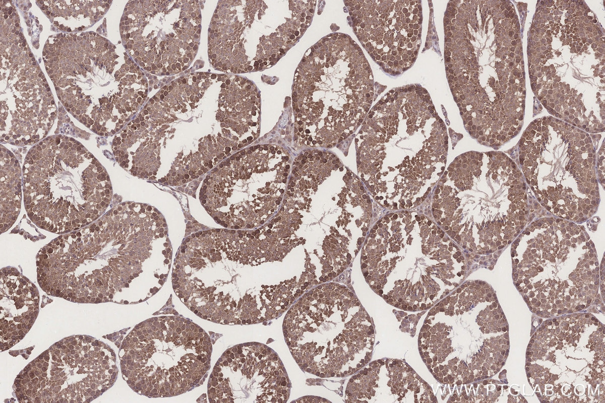 Immunohistochemistry (IHC) staining of mouse testis tissue using NT5C2 Polyclonal antibody (15223-1-AP)