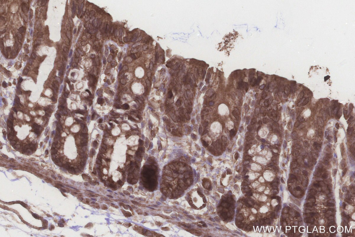 Immunohistochemistry (IHC) staining of rat colon tissue using NT5C2 Polyclonal antibody (15223-1-AP)