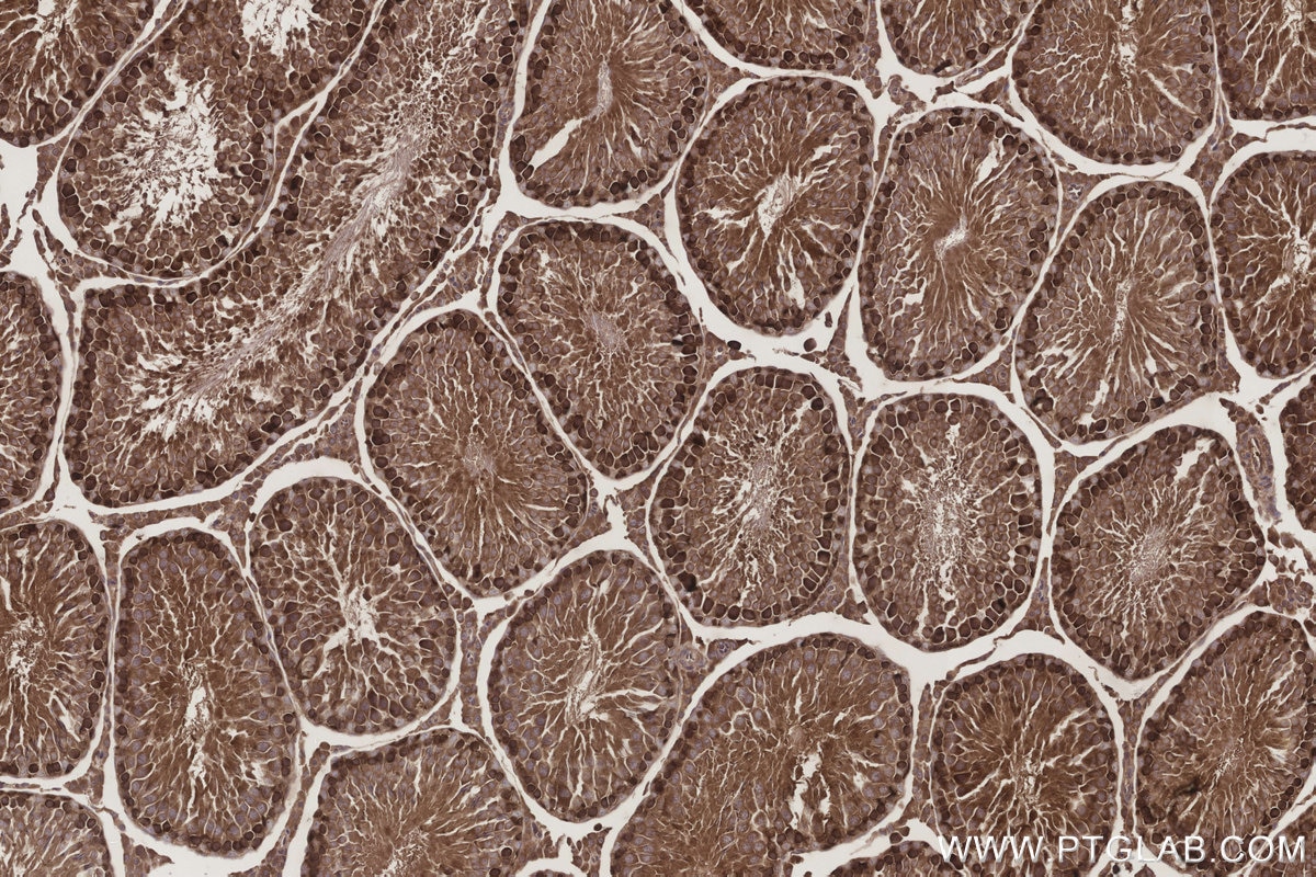Immunohistochemistry (IHC) staining of rat testis tissue using NT5C2 Polyclonal antibody (15223-1-AP)