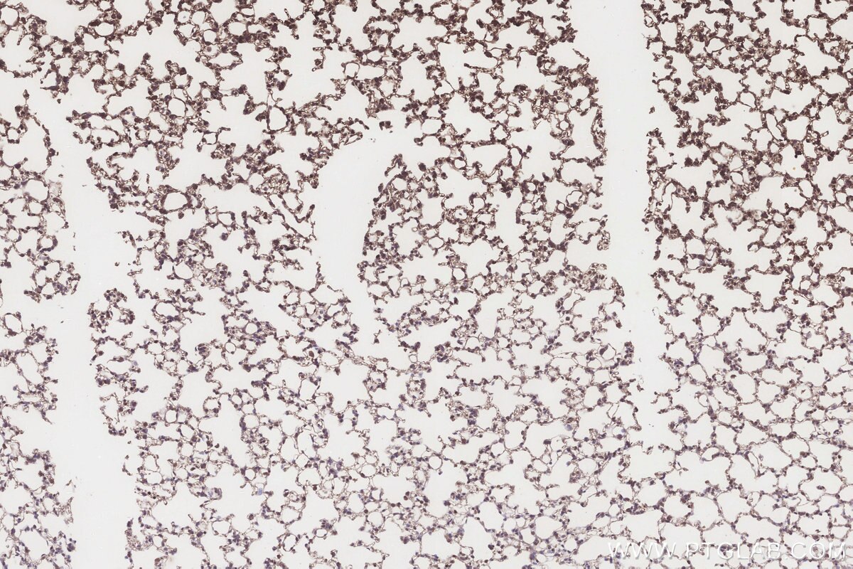 Immunohistochemistry (IHC) staining of mouse lung tissue using NT5C2 Polyclonal antibody (15223-1-AP)
