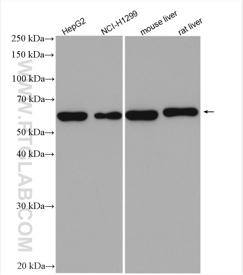 Western Blot (WB) analysis of various lysates using NT5C2 Polyclonal antibody (15223-1-AP)