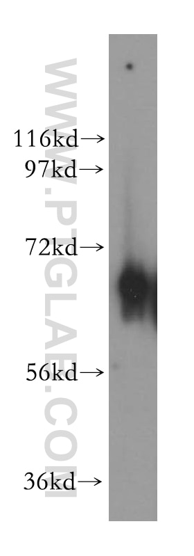 Western Blot (WB) analysis of human placenta tissue using NT5C2 Polyclonal antibody (15223-1-AP)