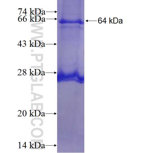 NT5C2 fusion protein Ag7438 SDS-PAGE