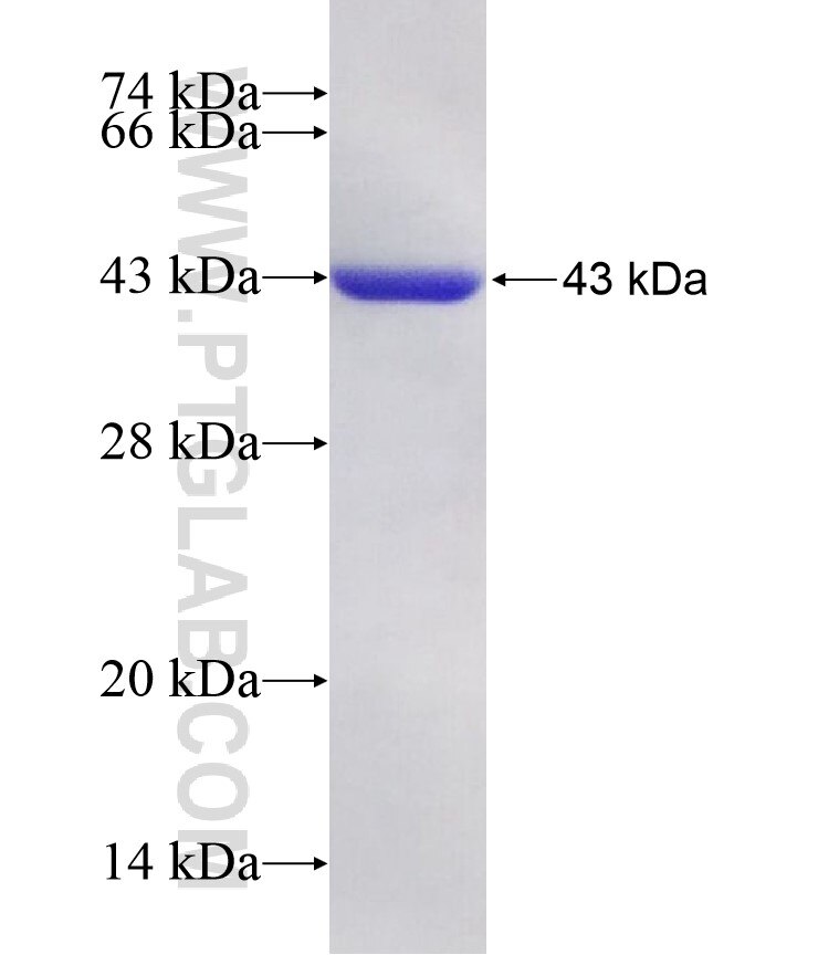 NT5C2 fusion protein Ag7461 SDS-PAGE