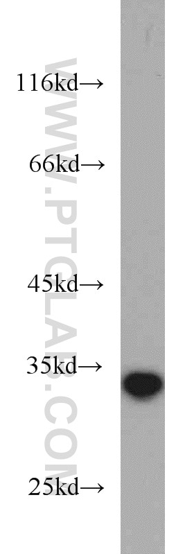 Western Blot (WB) analysis of human skeletal muscle tissue using NT5C3 Polyclonal antibody (11393-1-AP)