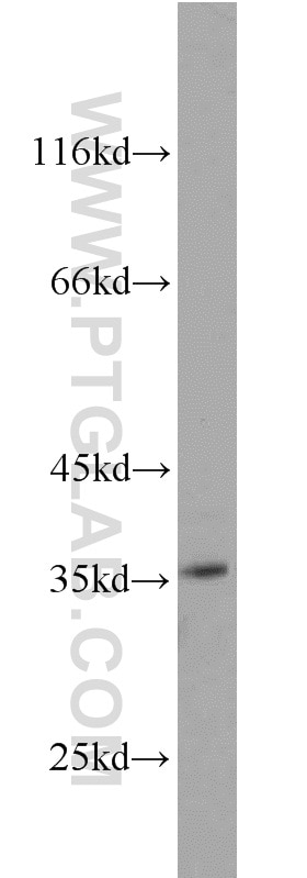 Western Blot (WB) analysis of mouse placenta tissue using NT5C3 Polyclonal antibody (11393-1-AP)