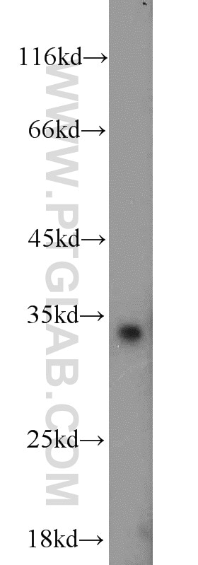 Western Blot (WB) analysis of mouse kidney tissue using NT5C3 Polyclonal antibody (11393-1-AP)