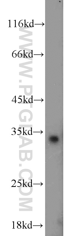 WB analysis of mouse kidney using 11393-1-AP