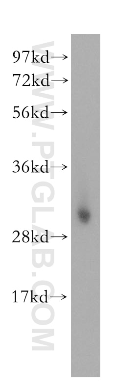 Western Blot (WB) analysis of human skeletal muscle tissue using NT5C3 Polyclonal antibody (11393-1-AP)