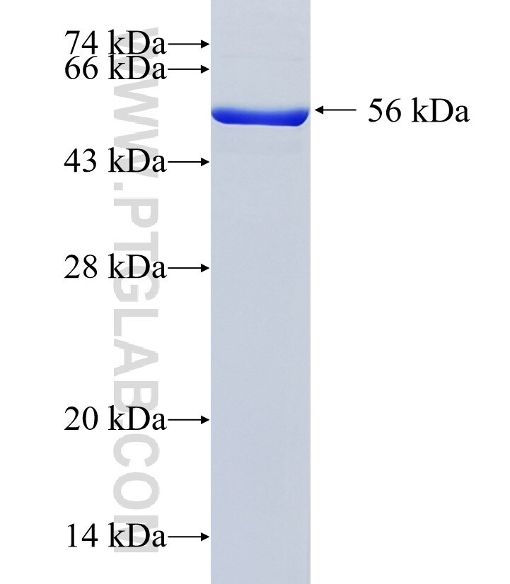 NT5C3 fusion protein Ag1949 SDS-PAGE