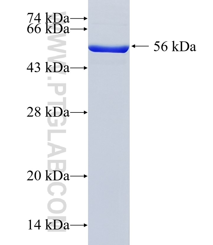 NT5C3 fusion protein Ag1949 SDS-PAGE