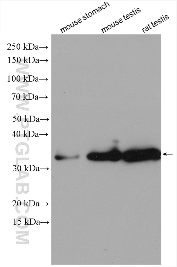 Western Blot (WB) analysis of mouse stomach tissue using NT5C3L Polyclonal antibody (16292-1-AP)