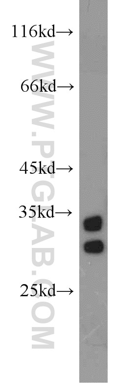 Western Blot (WB) analysis of human testis tissue using NT5C3L Polyclonal antibody (16292-1-AP)