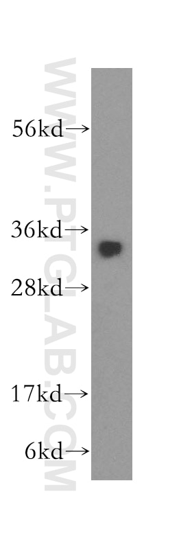 Western Blot (WB) analysis of human testis tissue using NT5C3L Polyclonal antibody (16292-1-AP)