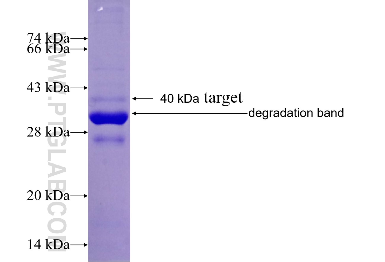 NT5C3L fusion protein Ag9441 SDS-PAGE