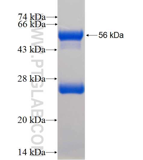 NT5C3L fusion protein Ag9458 SDS-PAGE