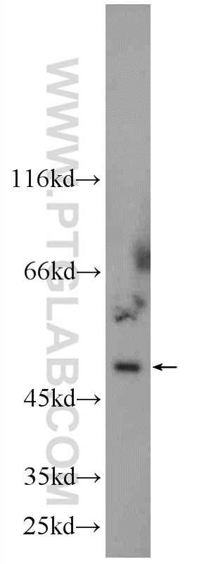 Western Blot (WB) analysis of Jurkat cells using NT5DC1 Polyclonal antibody (24102-1-AP)