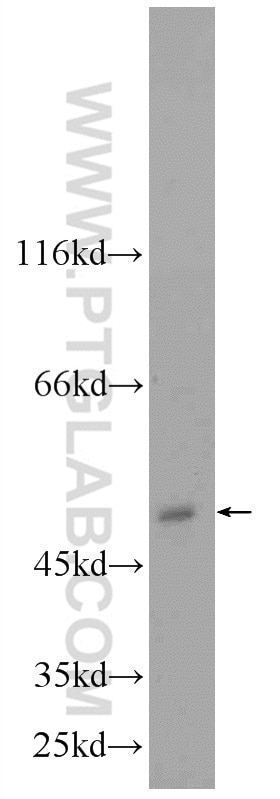 Western Blot (WB) analysis of HepG2 cells using NT5DC1 Polyclonal antibody (24102-1-AP)