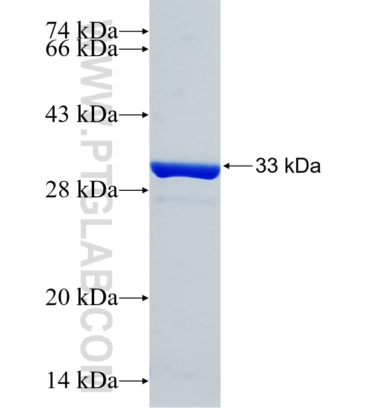 NT5DC2 fusion protein Ag35015 SDS-PAGE