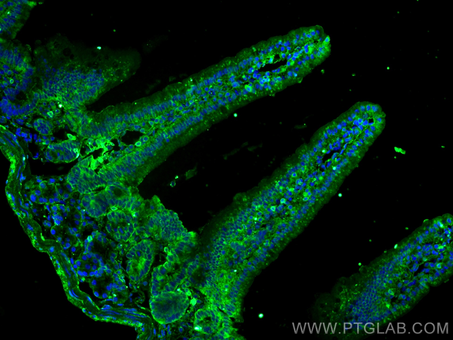 Immunofluorescence (IF) / fluorescent staining of mouse small intestine tissue using NT5E/CD73 Polyclonal antibody (12231-1-AP)