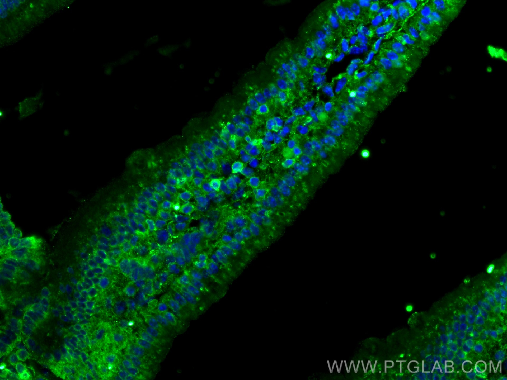 Immunofluorescence (IF) / fluorescent staining of mouse small intestine tissue using NT5E/CD73 Polyclonal antibody (12231-1-AP)